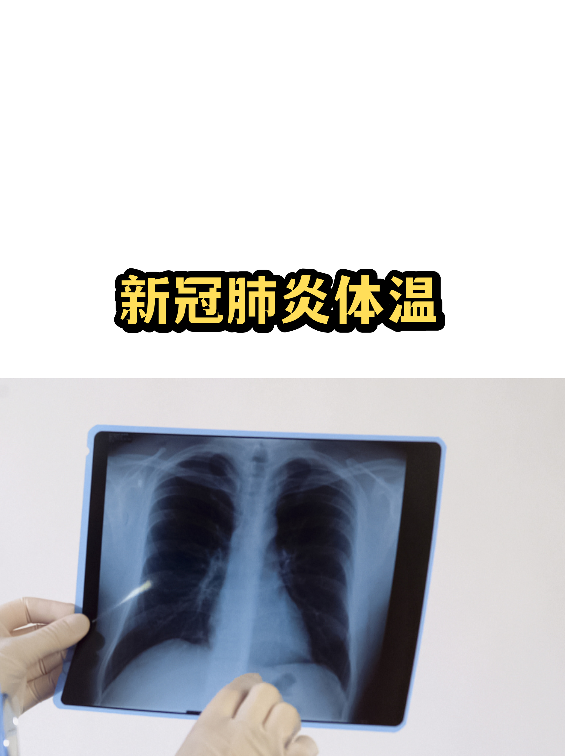 【疫情地区发烧怎么办,疫情内发烧怎么办】-第1张图片