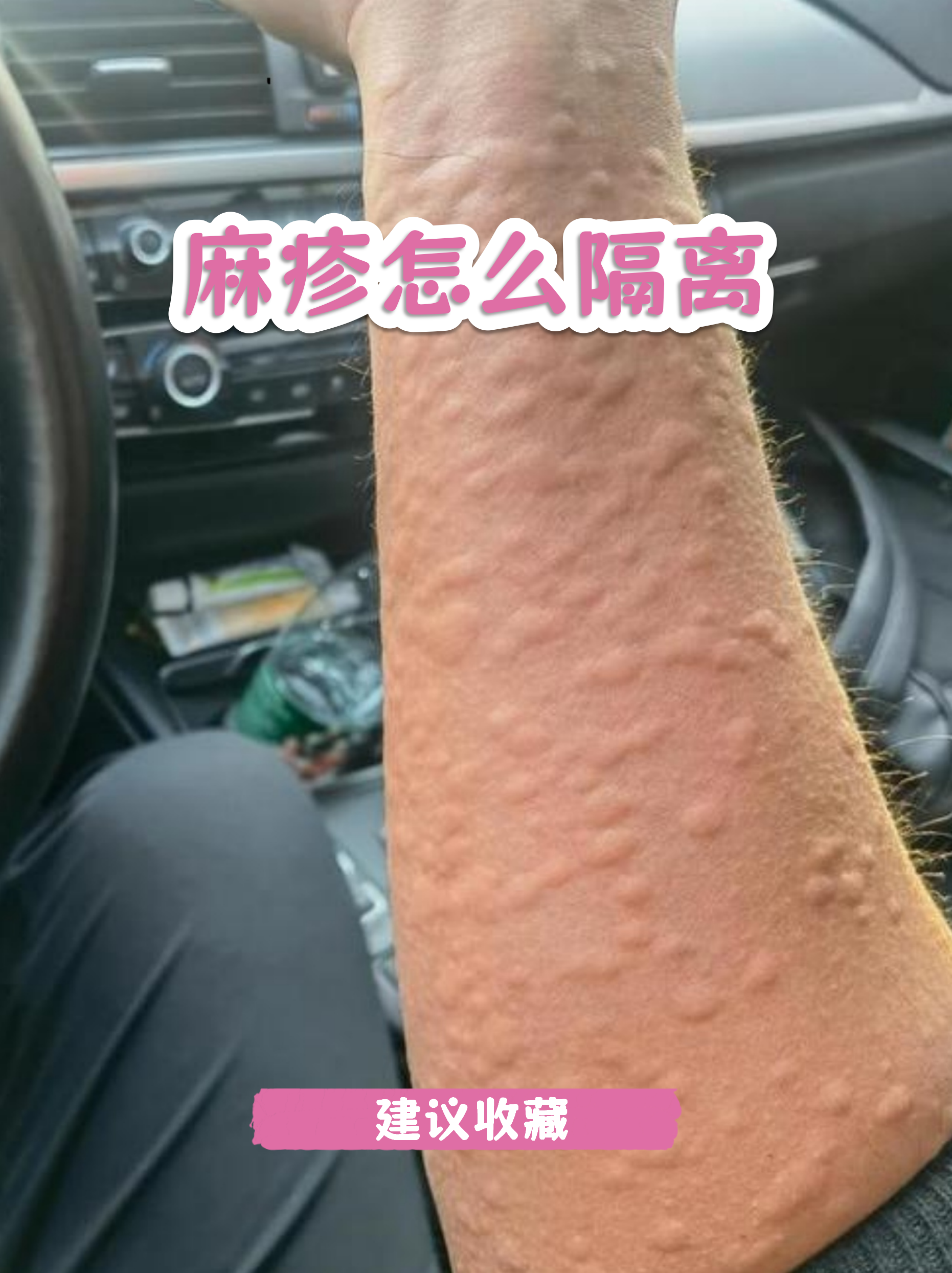 【其他地区的疫情如何,疫情地区到别的地方是怎么隔离的】-第1张图片